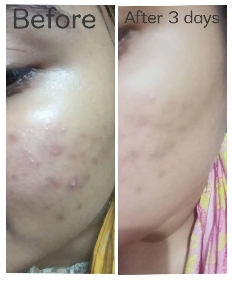WhatsApp-Image-2024-02-04-at-1.12.37-PM.webp